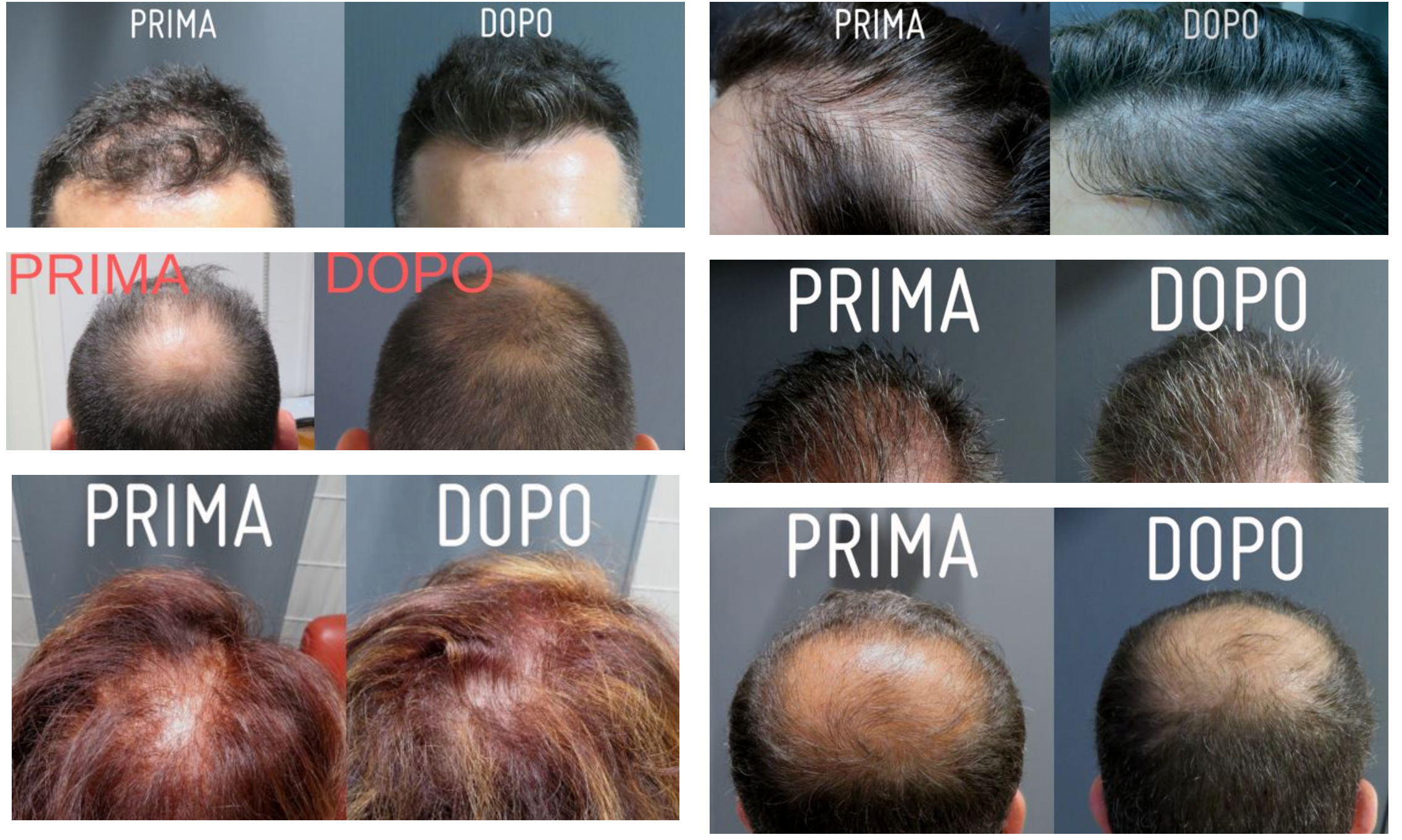 metodo prima dopo